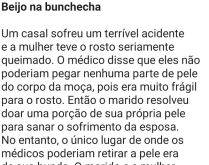 Beijo na buchecha. Um casal sofreu um acidente e a mulher teve o rosto....